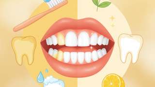 牙黄太尴尬？教你怎么去黄牙，还有怎么去黄牙渍小窍门快收好